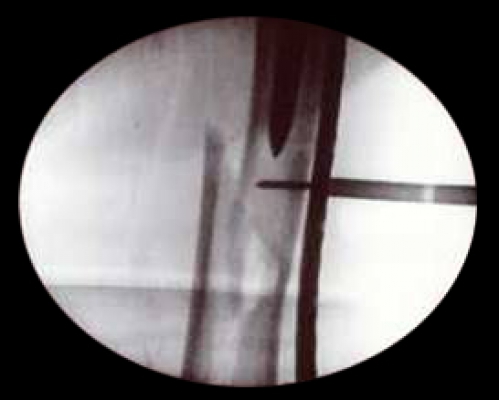 Click to enlarge image 8.5-21.jpg