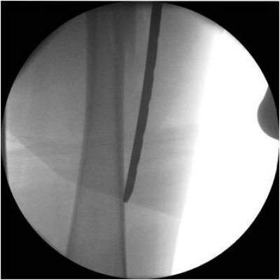 Click to enlarge image 6.2-11.jpg