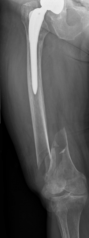 Click to enlarge image 12.3.2-11.jpg