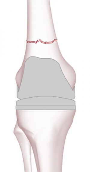 Click to enlarge image 2.2.1-16.jpg