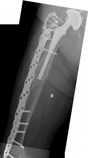 Click to enlarge image vancouver-b1-simple-case-1-4-3.jpg