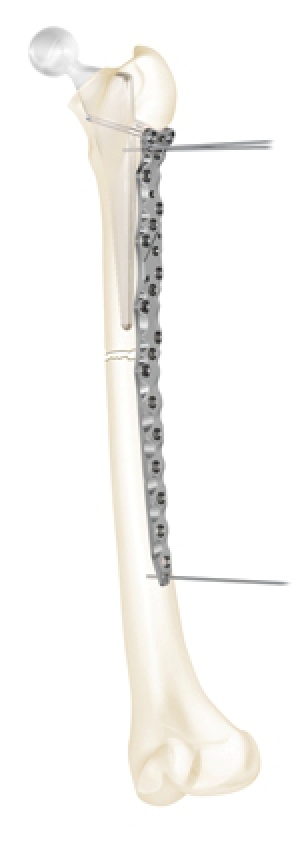 Click to enlarge image 5.4-11.jpg