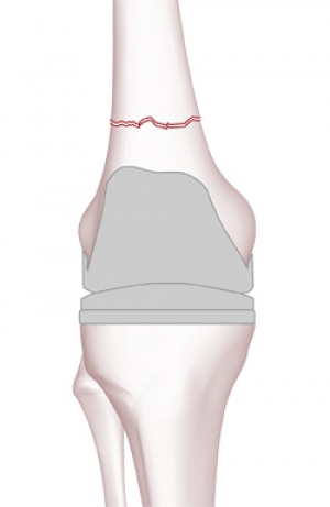 Click to enlarge image 2.2.1-1-0.jpg