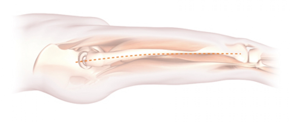 Click to enlarge image 3.5.4.1-11.jpg