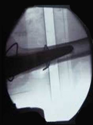 Click to enlarge image 5.2-4d.jpg